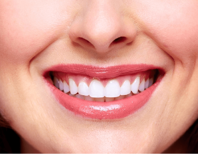7 فایده از کاشت دندان چیست؟
